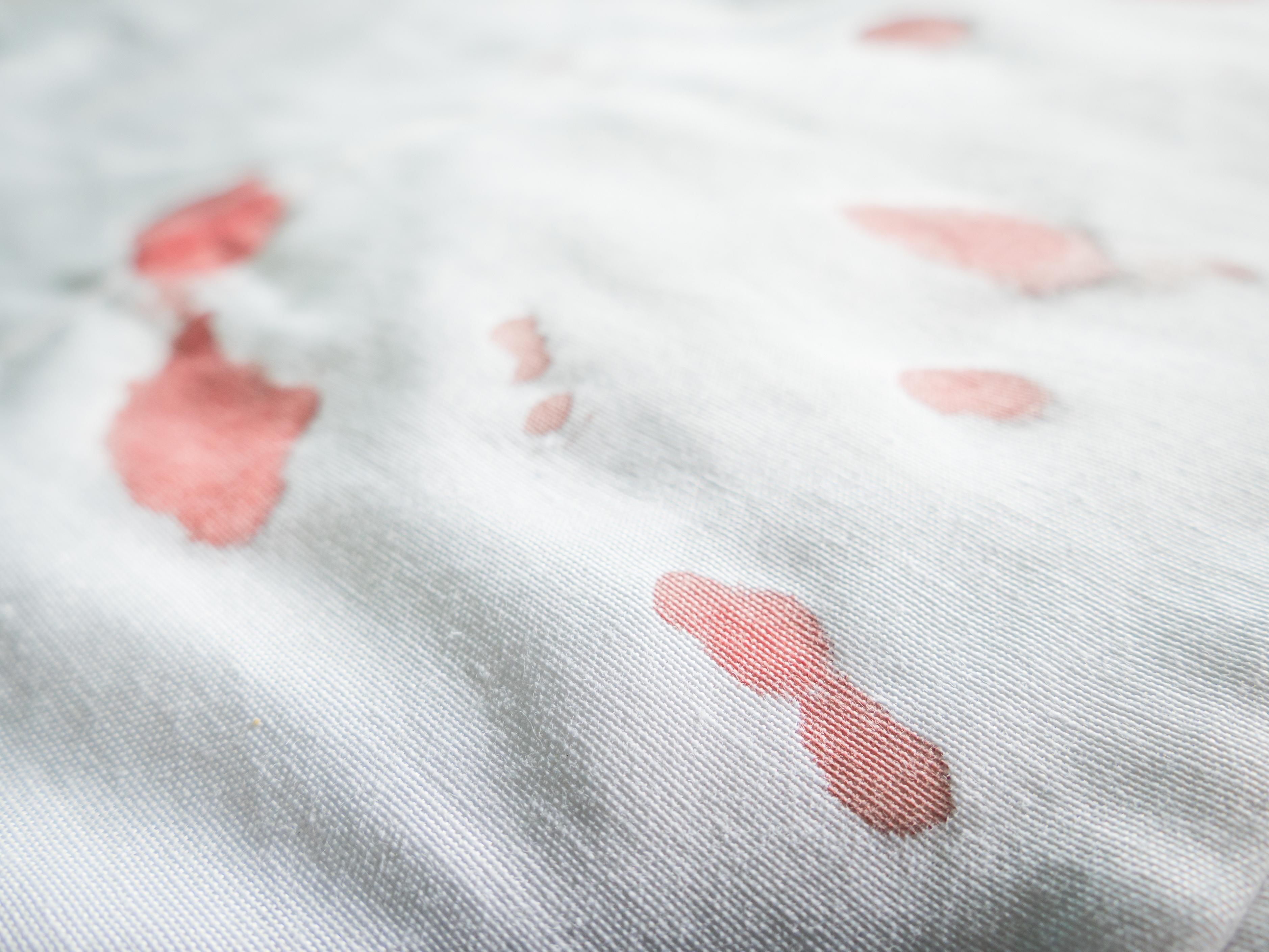 Blutflecken Entfernen Sofa Jeans Teppich Die Besten Hausmittel Heilpraxis