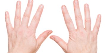 Dünne Fingernägel können unterschiedlichste Ursachen haben, lassen sich jedoch oft mit Hausmitteln erfolgreich beheben. (Bild: bmf-foto.de/fotolia.com)