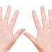 Dünne Fingernägel können unterschiedlichste Ursachen haben, lassen sich jedoch oft mit Hausmitteln erfolgreich beheben. (Bild: bmf-foto.de/fotolia.com)
