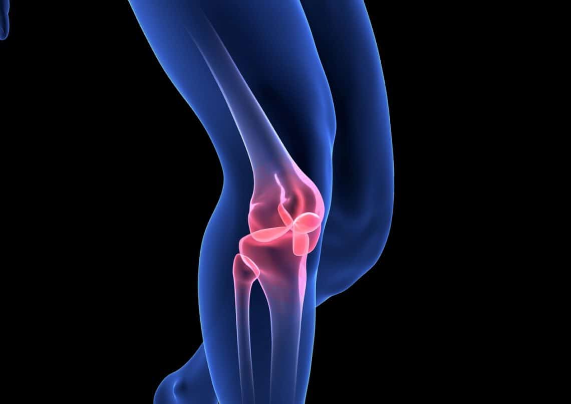 Knie verdreht Symptome, Behandlung und erste Hilfe Heilpraxis