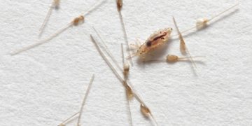 Die Autorinnen Monika Niehaus und Andrea Pfuhl beschreiben in ihrem Buch, welchen Einfluss Läuse und andere Parasiten auf den Menschen haben. (Bild: pridannikov/fotolia.com)