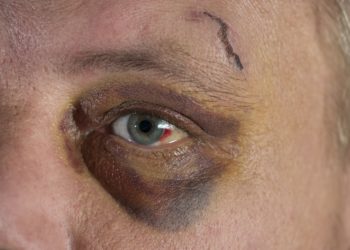 Nahaufnahme eines blauen Auges bei einem Mann.