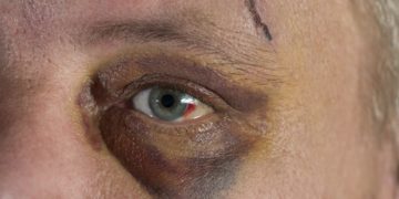 Nahaufnahme eines blauen Auges bei einem Mann.