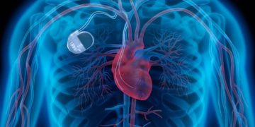Der weltweit größte Hersteller von Medizinprodukten, Medtronic, muss einige Modelle eines Herzschrittmachers zurückrufen.  (Bild: psdesign1/fotolia.com)