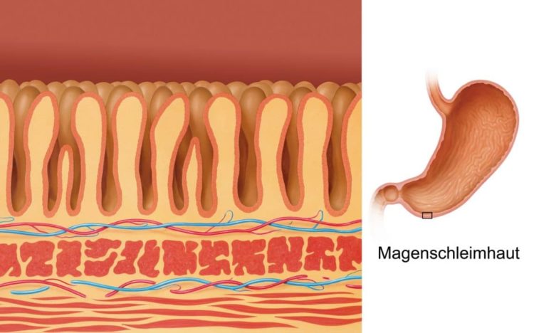 Wie Merkt Man Eine Magenschleimhautentzündung
