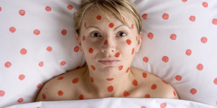 Frau im Bett umkreist von roten Punkten.