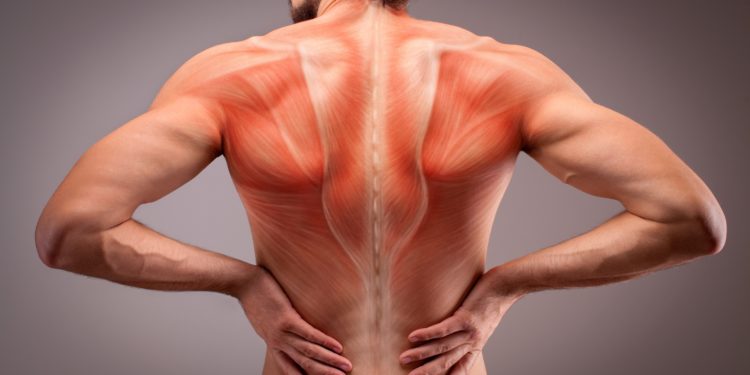 Muskelschmerzen Ursachen Und Behandlung Naturheilkunde