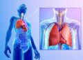 Eine Rippenfellentzündung (Pleuritis) bedarf dringend ärztlicher Behandlung, da ansonsten schwere Komplikationen drohen. (Bild: pixdesign123/fotolia.com)