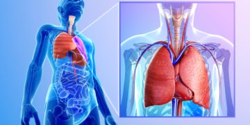 Eine Rippenfellentzündung (Pleuritis) bedarf dringend ärztlicher Behandlung, da ansonsten schwere Komplikationen drohen. (Bild: pixdesign123/fotolia.com)