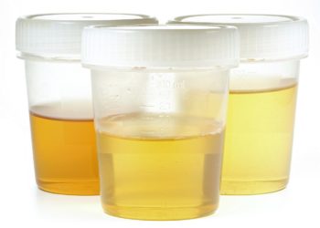 Die Farbe des Urins ensteht durch darin vorkommende Stoffwechselprodukte (Urochrome). (Bild: Björn Wylezich/fotolia.com)