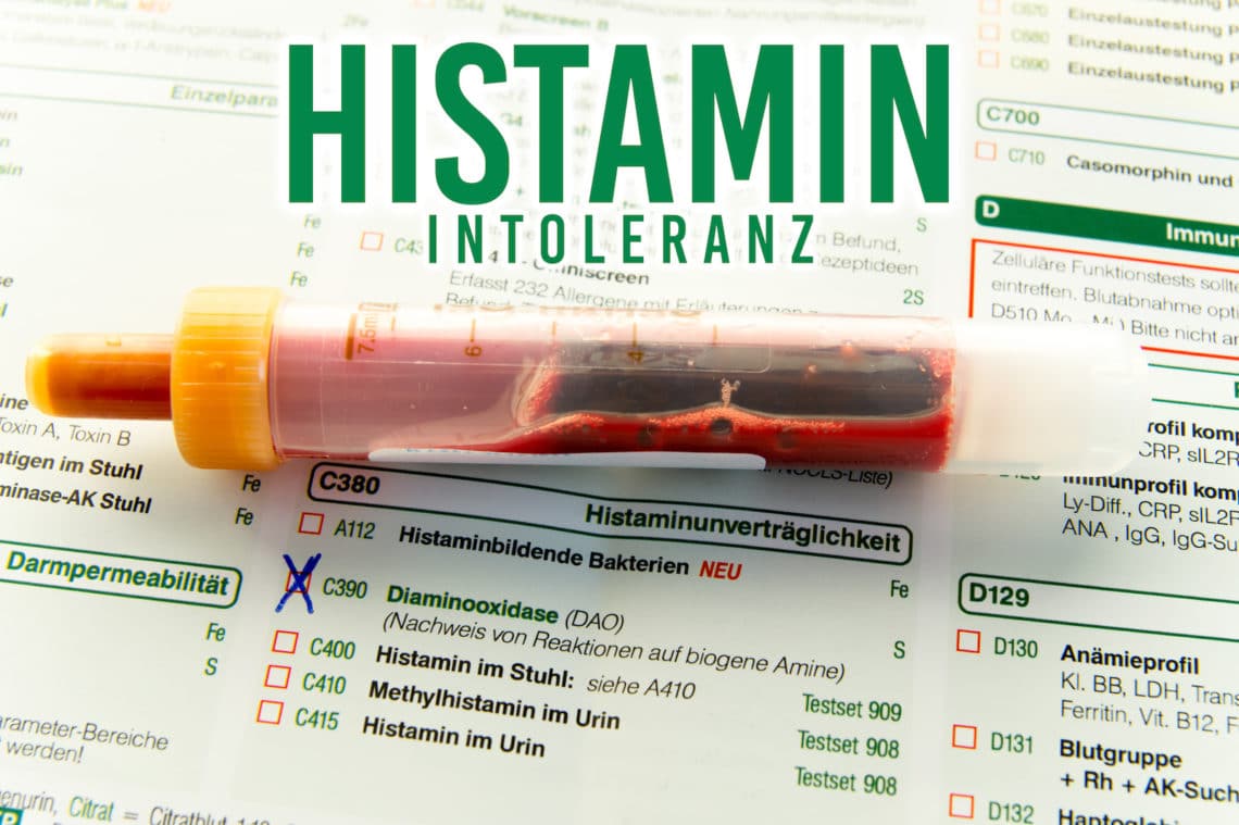 Histaminallergie – Ursachen, Symptome und Therapie – Heilpraxis