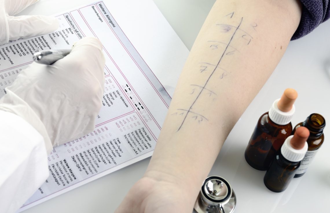 Luxus Histamin Allergie Test Bilder