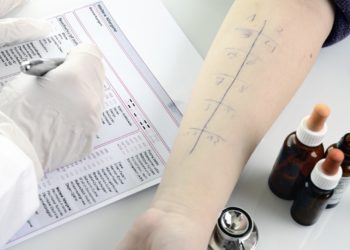 Es muss keine Histamin-Allergie sein. Ein Test kann Allergien aufspüren. Bild: Gerhard Seybert-fotolia