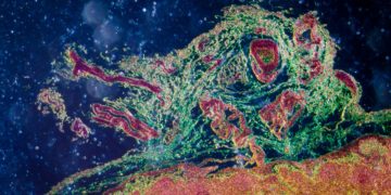 Eine Lymphgefäßsentzündung kann sich auf die Lymphknoten ausweiten, wenn die Bakterien ins dortige Lymphgewebe gelangen (Bild: defun/fotolia.com)