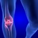 Bei der Arthritis handelt es sich um eine entzündliche Gelenkerkrankung, die durch Keime oder durch rheumatoide Erkrankungen entstehen kann. (Bild: m3ron/fotolia.com)