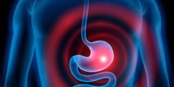 Bei einer Magenkolik verkrampft Muskulatur des Hohlorgans, was heftige Schmerzen verursacht. (Bild: psdesign1/fotolia.com)