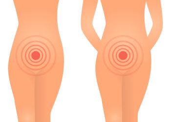 Scheidenkrampf bezeichnet eine sexuelle Funktionsstörung, bei der es zu spontanen Verkrampfungen der Vaginalmuskulatur kommt. (Bild: akiradesigns/fotolia.com)