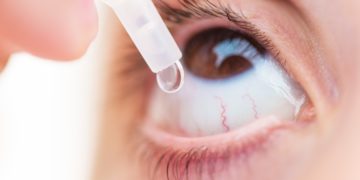 Augentropfen begleiten Patientinnen und Patienten mit krankhaft verändertem Augeninnendruck meist ein Leben lang. (Bild: Stefano Garau/stock.adobe.com)