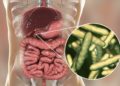 Eine Zwölffingerdarmentzündung geht häufig auf Infektionen mit dem Bakterium Helicobacter pylori zurück, kann jedoch auch durch zahlreiche andere Faktoren bedingt werden. (Bild: Kateryna_Kon/fotolia.com)