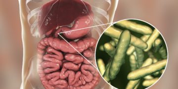 Eine Zwölffingerdarmentzündung geht häufig auf Infektionen mit dem Bakterium Helicobacter pylori zurück, kann jedoch auch durch zahlreiche andere Faktoren bedingt werden. (Bild: Kateryna_Kon/fotolia.com)