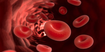 Dickes Blut beschreibt eine über das Normalmaß hinaus vorliegende Konzentration von roten Blutkörperchen (Erythrozyten), was für die Gesundheit ernste Probleme bedeuten kann. (Bild: fotomek/fotolia.com)