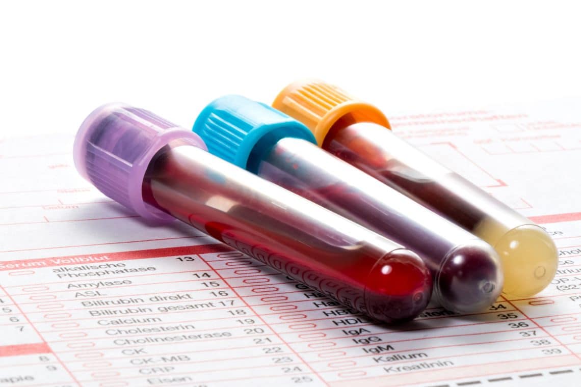 Dickes Blut – Ursachen, Symptome und Behandlung – Heilpraxis