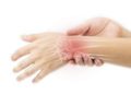Eine Hand, bei der die Knochen des Handgelenks visuell hervorgehoben sind.