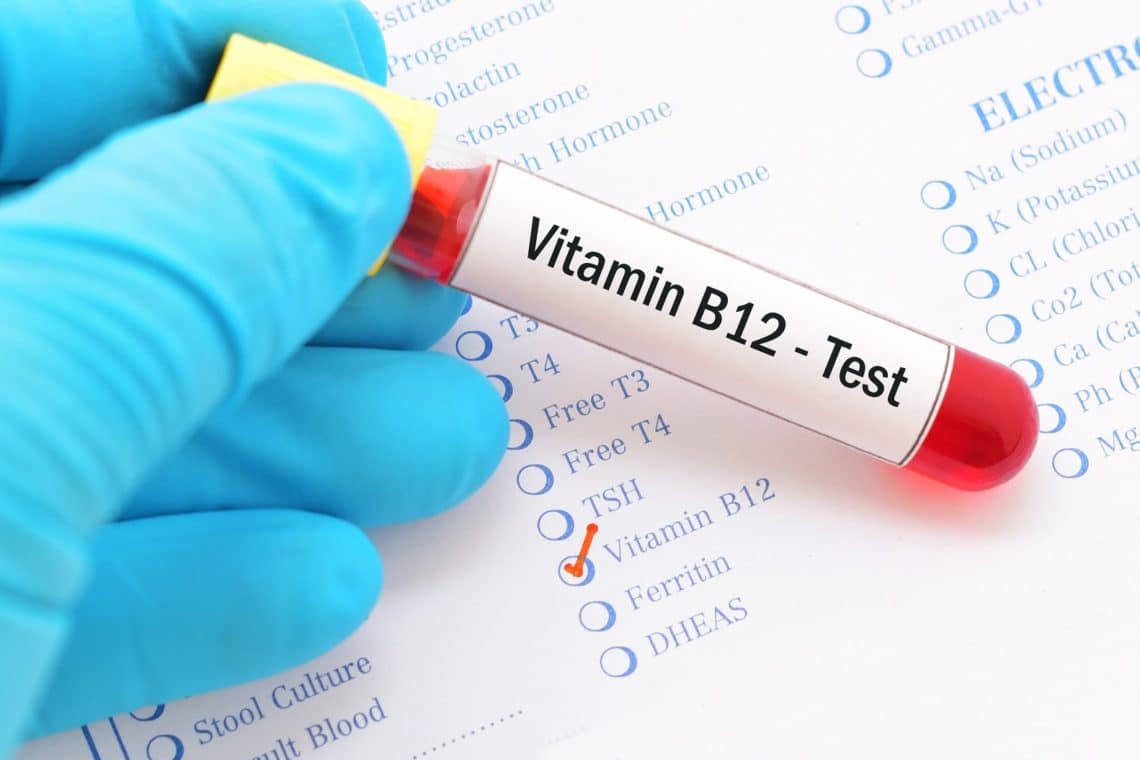 Bluthochdruck Durch Vitamin B12 Mangel www.heilpraxisnet.de