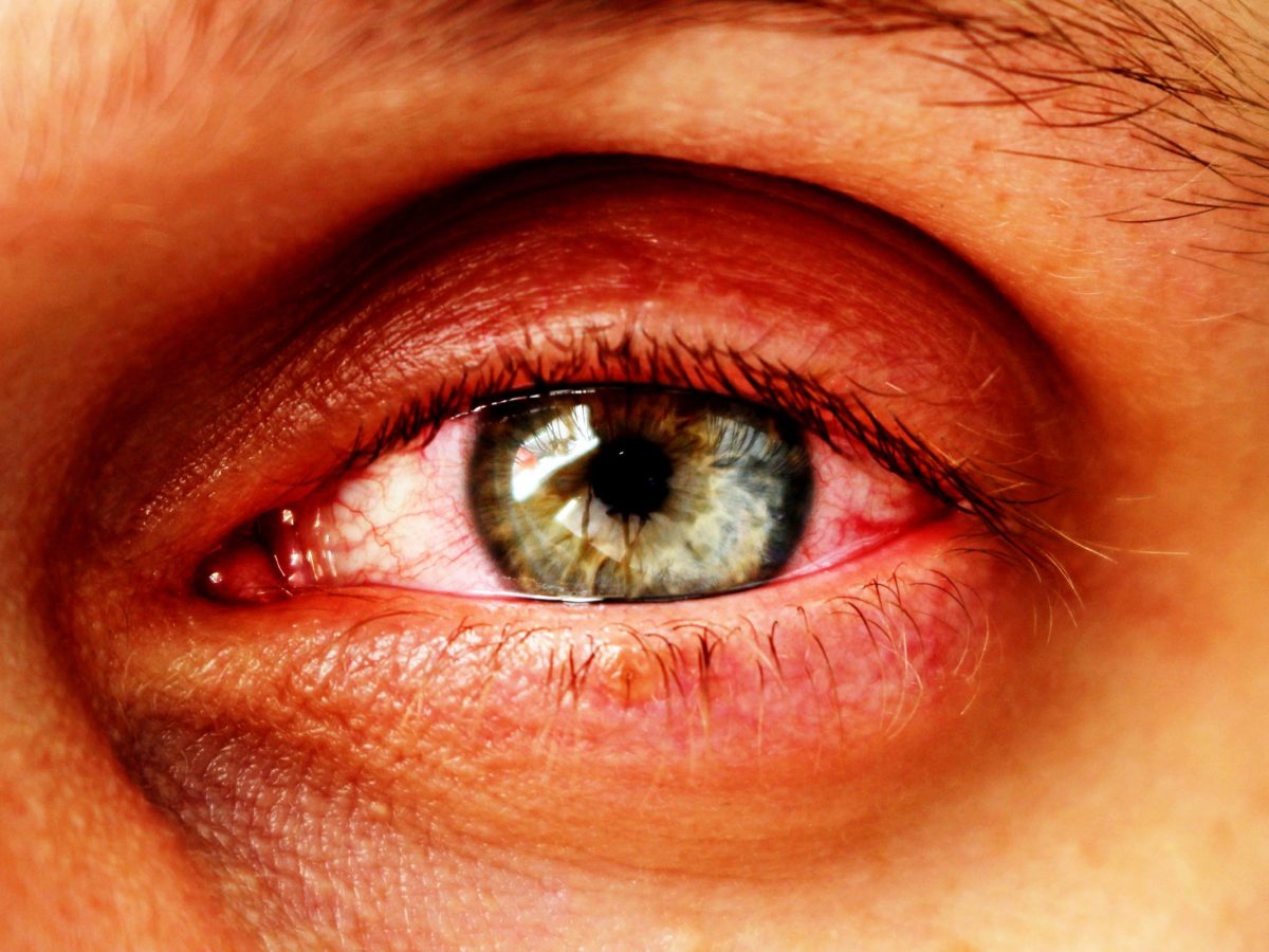 Augeninnendruck messen bei diabetes
