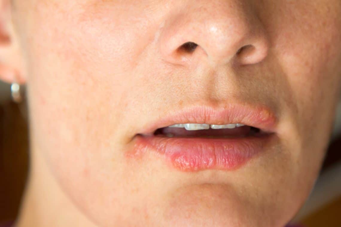 Rote Punkte auf der Haut – Heilpraxis