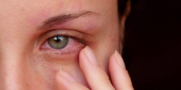 Ein rotes Auge ist oftmals das erste Anzeichen für eine Bindehautentzündung.(Bild: julia_diak/fotolia.com)