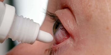 Antibiotische Augentropfen werden bei den meisten bakteriellen Infektionen eingesetzt, aber auch künstliche Tränenflüssigkeit kann helfen Beschwerden einer Konjunktivitis zu mildern. (Bild: Cpro/fotolia.com)
