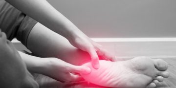 Gelengentliche Fußsohlenschmerzen nach anstrengenden Tagen sind normal und den meisten Menschen bekannt. Leiden Betroffene jedoch regelmäßig und ohne erkennbaren Grund unter solchen Schmerzen, kann eine therapiebedürftige Erkrankung die Ursache sein. (Bild: catinsyrup/stock.adobe.com)