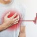 Hauptsymptom der koronaren Herzkrankheit ist die Angina pectoris, eine anfallsartige Brustenge mit Brustschmerzen die auch ausstrahlen können. (Bild: sasinparaksa/fotolia.com)
