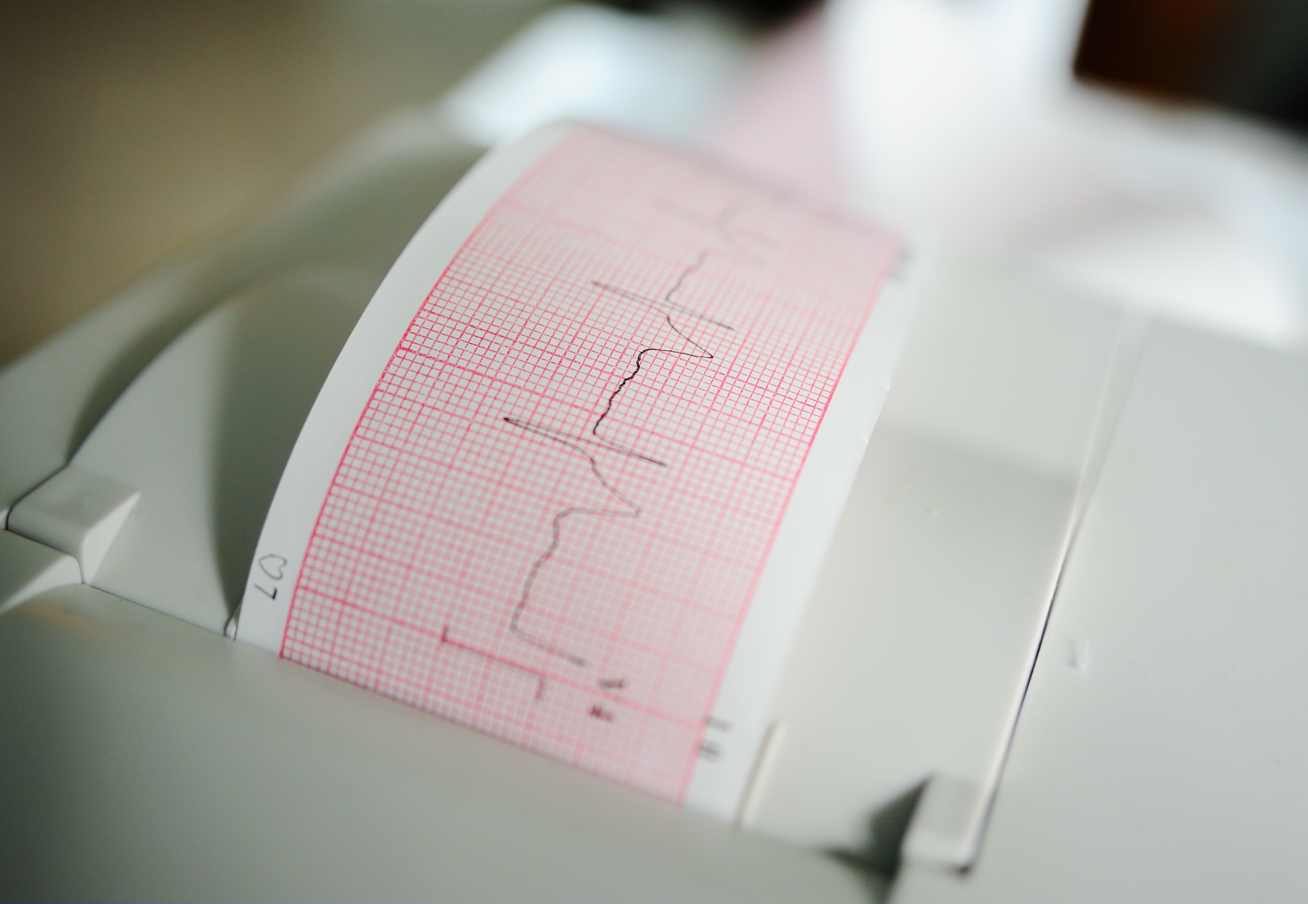 Ekg Am Handgelenk Bestimmte Herzrhythmusstorungen Einfach Mittels