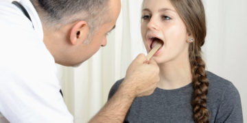 Eine ärztliche Untersuchung ist im Fall der akuten Mandelentzündung mit zahlreichen weiteren Symptomen grundsätzlich geboten. (Bild: Dan Race/stock.adobe.com)