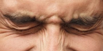Die bei einem Blepharospasmus hervorgerufenen Augenlidkrämpfe können Betroffene stark beeinträchtigen. (Bild: Damir/fotolia.com)