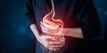 Der Barrett-Ösophagus ist eine ernsthafte Erkrankung bei chronischem Reflux und birgt ein erhöhtes Kebsrisiko. (Bild: ipopba/fotolia.com)