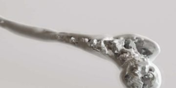 Ein übermäßiger Knochenabbau (Osteolyse im medizinischen Sinn) kann schwerwiegende Folgen haben. (Bild: crevis/fotolia.com)