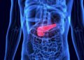 Der Gallenstau tritt häufig in Verbindung mit einem Gallensteinleiden auf, aber auch andere Gesundheitsbeschwerden können zu einer Cholestase führen. (Bild: PIC4U/fotolia.com)