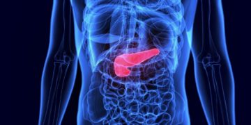 Der Gallenstau tritt häufig in Verbindung mit einem Gallensteinleiden auf, aber auch andere Gesundheitsbeschwerden können zu einer Cholestase führen. (Bild: PIC4U/fotolia.com)