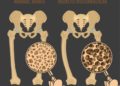 Die schwere Folge einer unzureichenden Mineralisierung der Knochen ist deren Erweichung und folglich deren Verformung, insbesondere in Bereichen mit hoher Belastung. (Bild: Double Brain/fotolia.com)