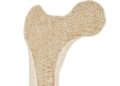 Bei einer Osteomyelitis treten Infektionen im Knochenmark und in angrenzenden Knochenbereichen auf. (Bild: Peter Hermes Furian/fotolia.com)