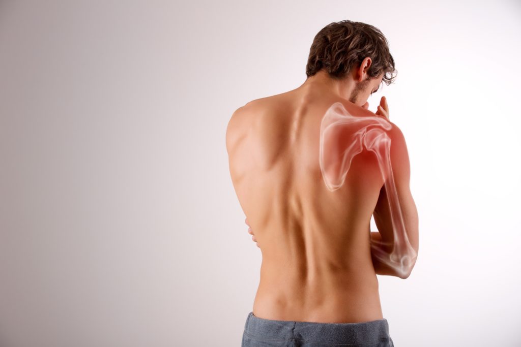 Schulterstechen Schmerzen Im Schultergelenk Heilpraxis 
