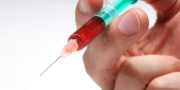 Bei Eigenbluttherapie werden kleine Mengen Blut aus der Vene entnommen, mit einem Ozon-Sauerstoff-Gemisch eingereichert und  wieder reinjiziert. (Bild: pixelstore/fotolia.com)