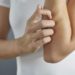 Ozontherapie als äußere Anwendung kann bei Ekzemenbehandlung helfen. (Bild: miamariam /fotolia.com)