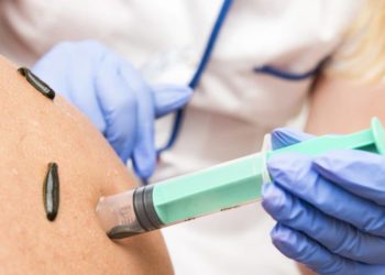 Anwendung einer Blutegeltherapie