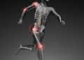 Computerdarstellung eines laufenden Körpers mit markierten Gelenkschmerzen