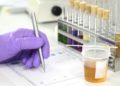 schreibende Hand und ein Urinbecher mit einem ph-Streifen