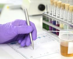 schreibende Hand und ein Urinbecher mit einem ph-Streifen